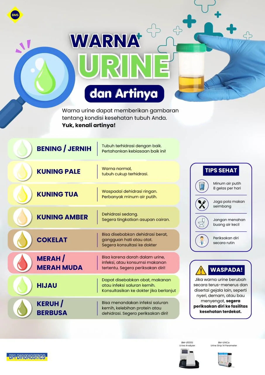 Poster Warna Urine dan Artinya